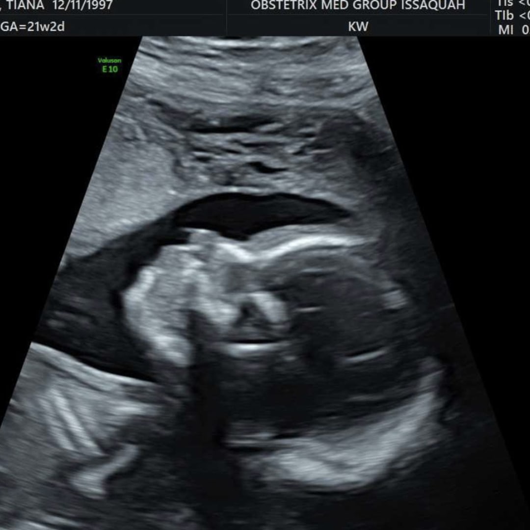 Photo shared by Zhanna for their Babylist baby registry.