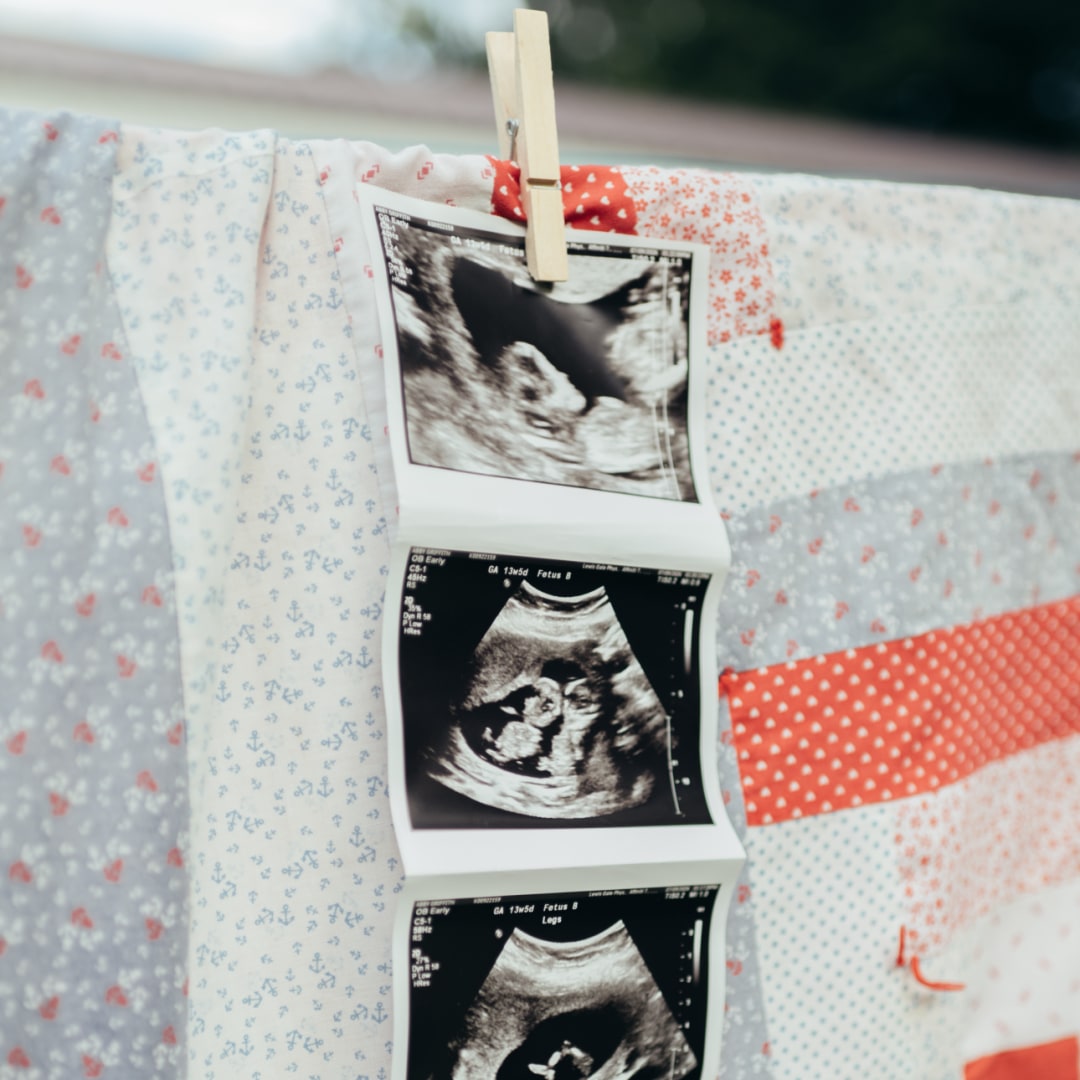 Photo shared by Abby for their Babylist baby registry.