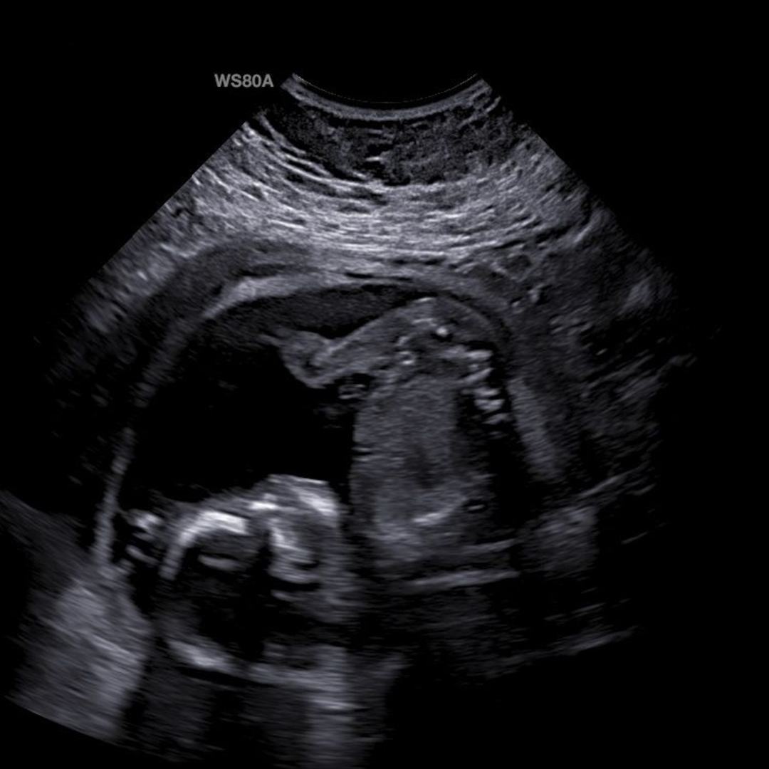 Photo shared by Casey for their Babylist baby registry.