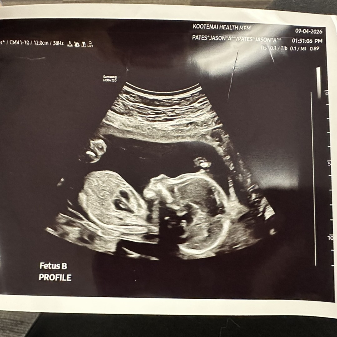 Photo shared by Rachel for their Babylist baby registry.