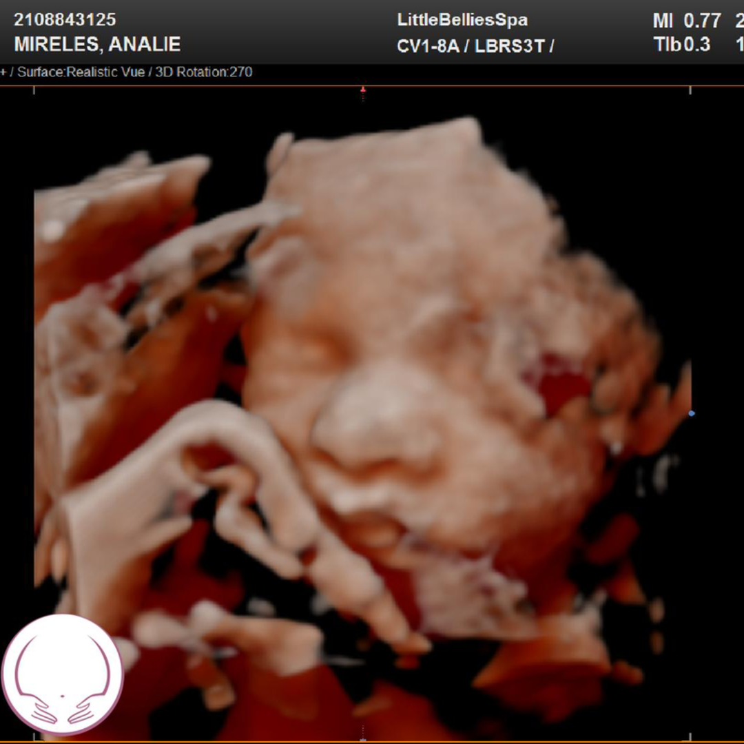 Photo shared by Analie for their Babylist baby registry.