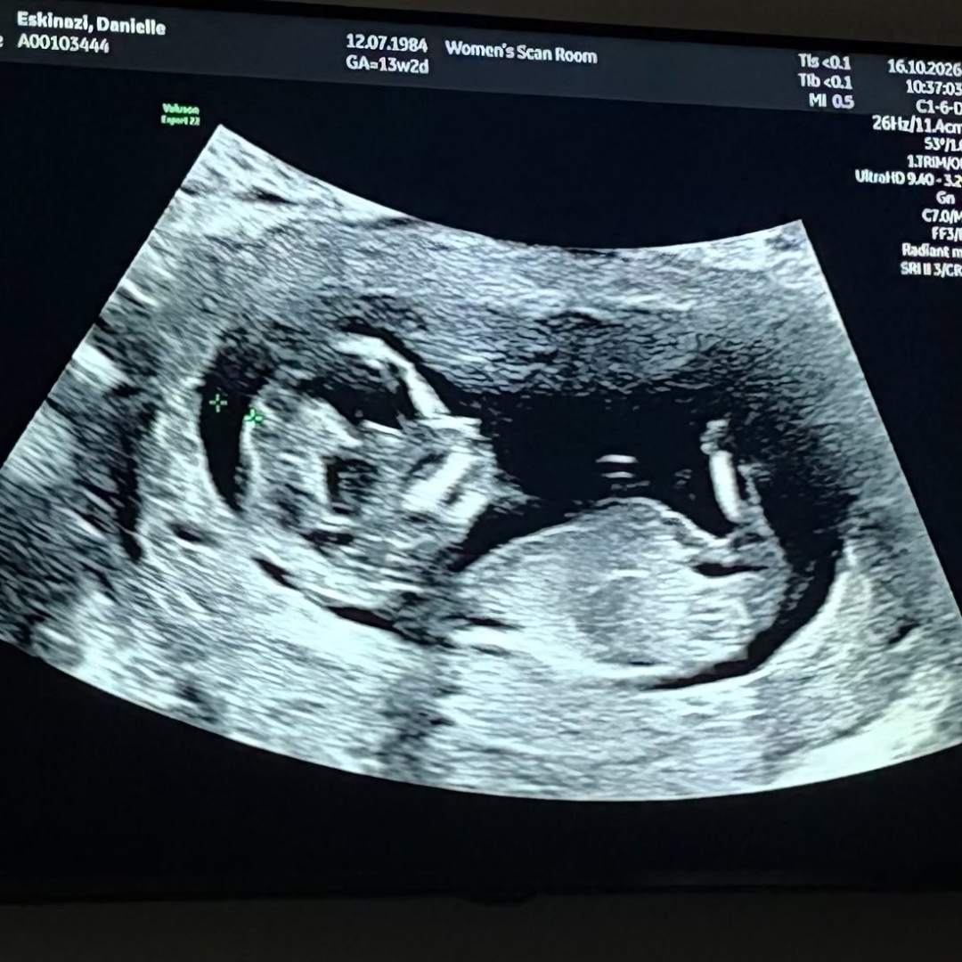 Photo shared by Danielle for their Babylist baby registry.