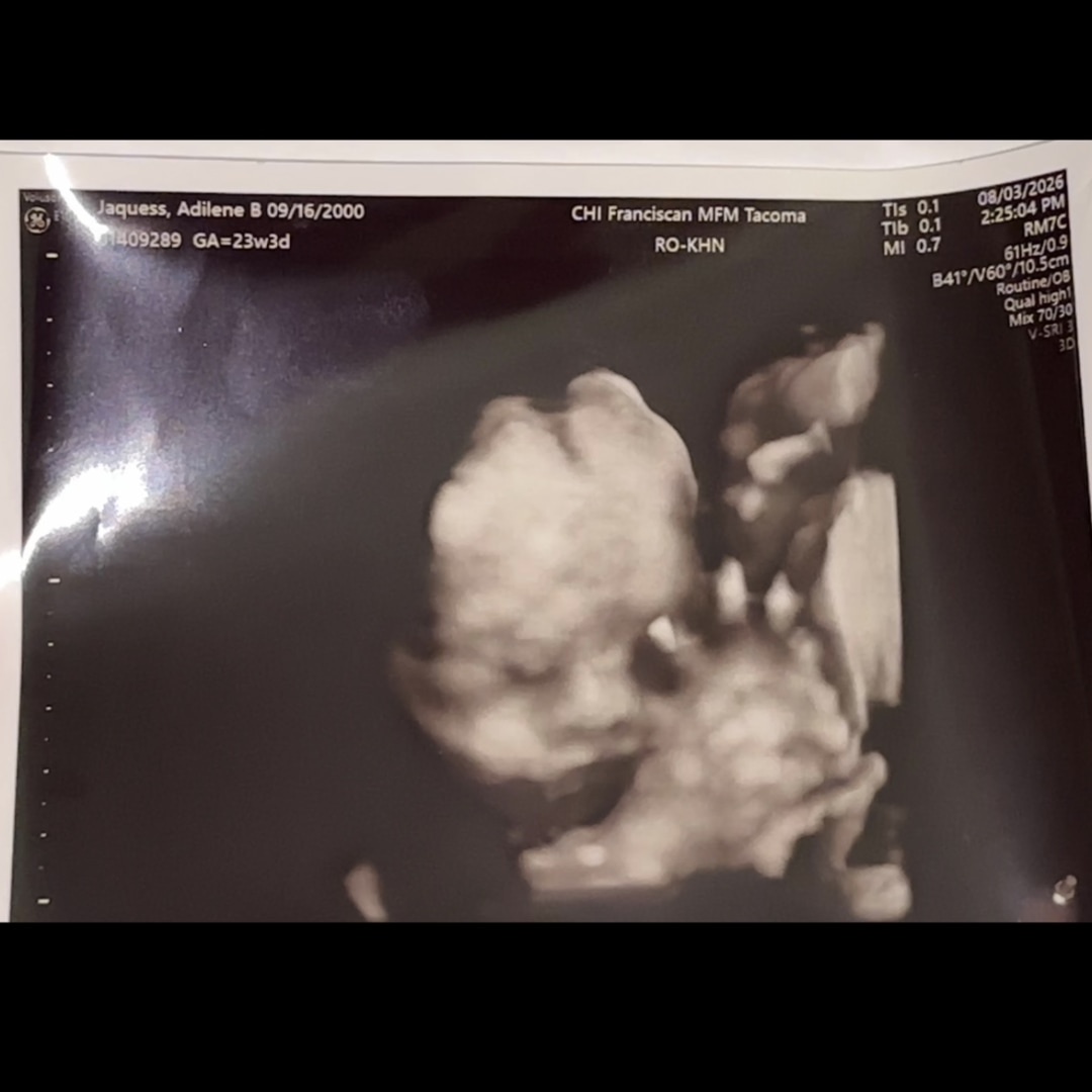 Photo shared by Adilene for their Babylist baby registry.
