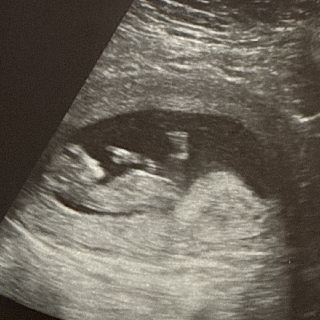 Photo shared by Kristy for their Babylist baby registry.