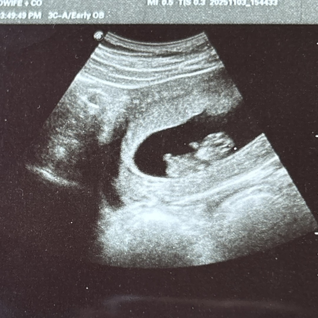 Photo shared by Kathryn for their Babylist baby registry.