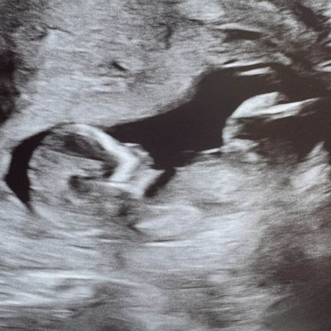 Photo shared by Christ Marie for their Babylist baby registry.