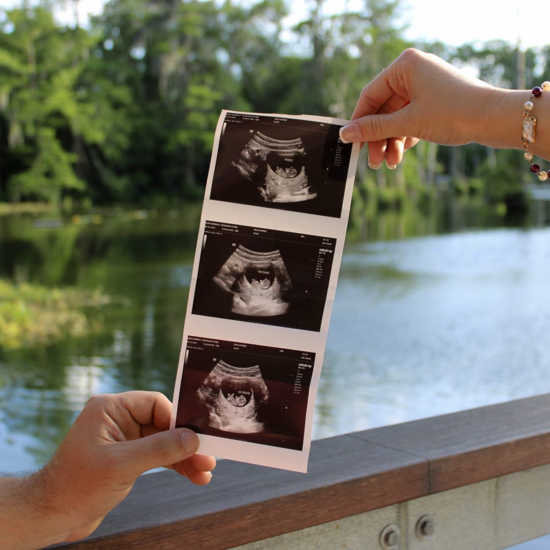 Photo shared by Vonnie for their Babylist baby registry.