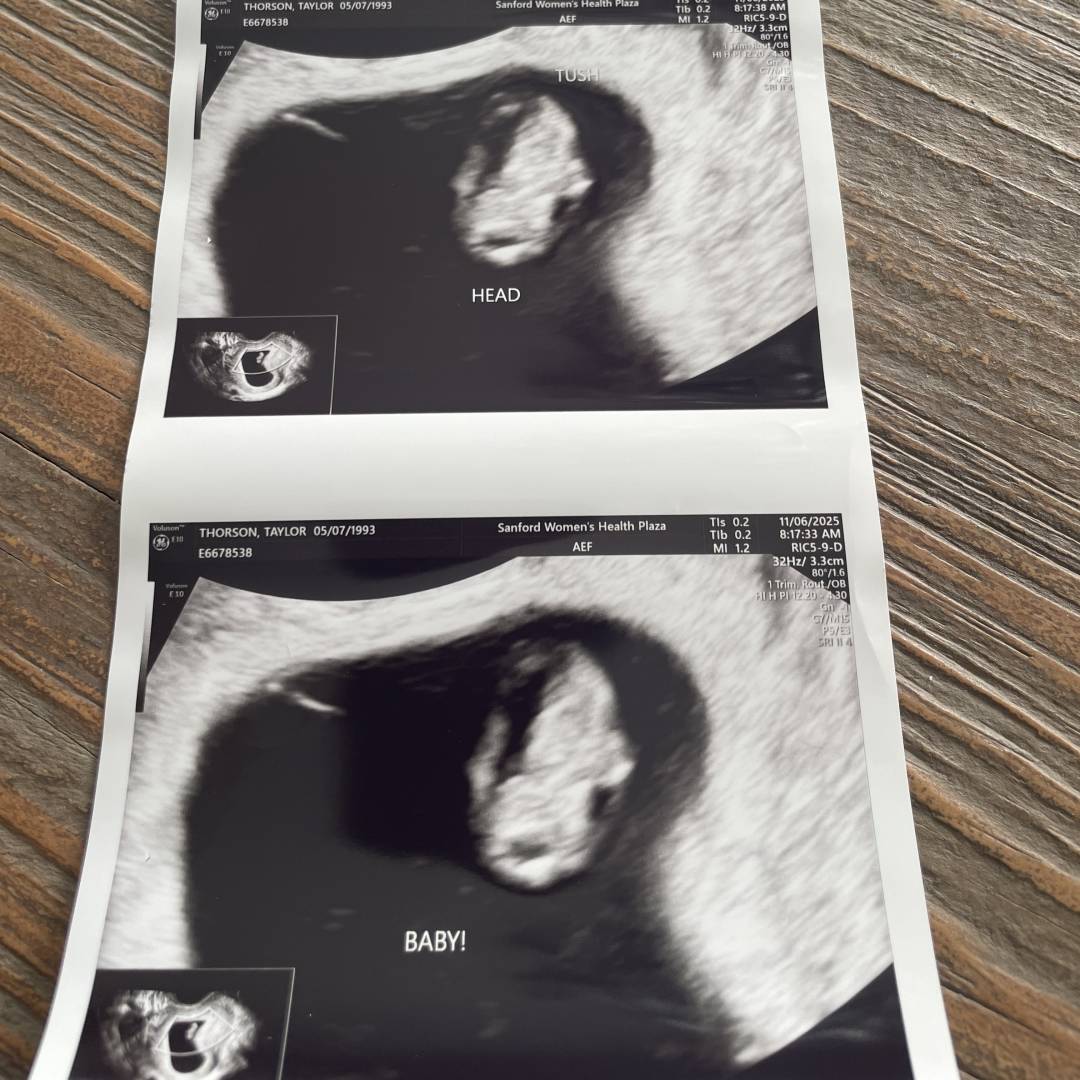 Photo shared by Taylor for their Babylist baby registry.