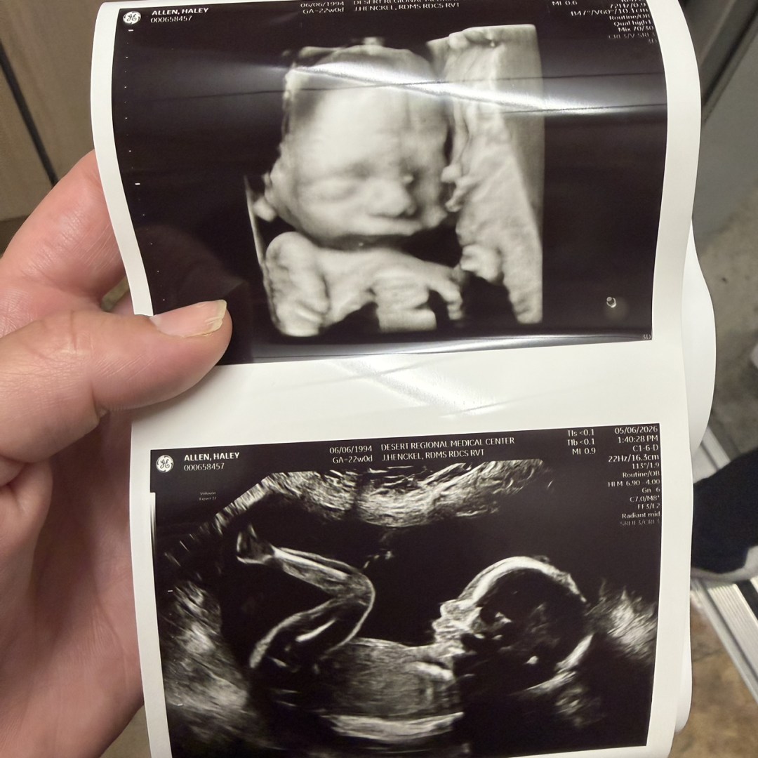 Photo shared by Haley for their Babylist baby registry.