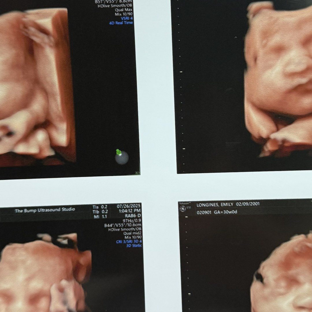 Photo shared by Emily for their Babylist baby registry.