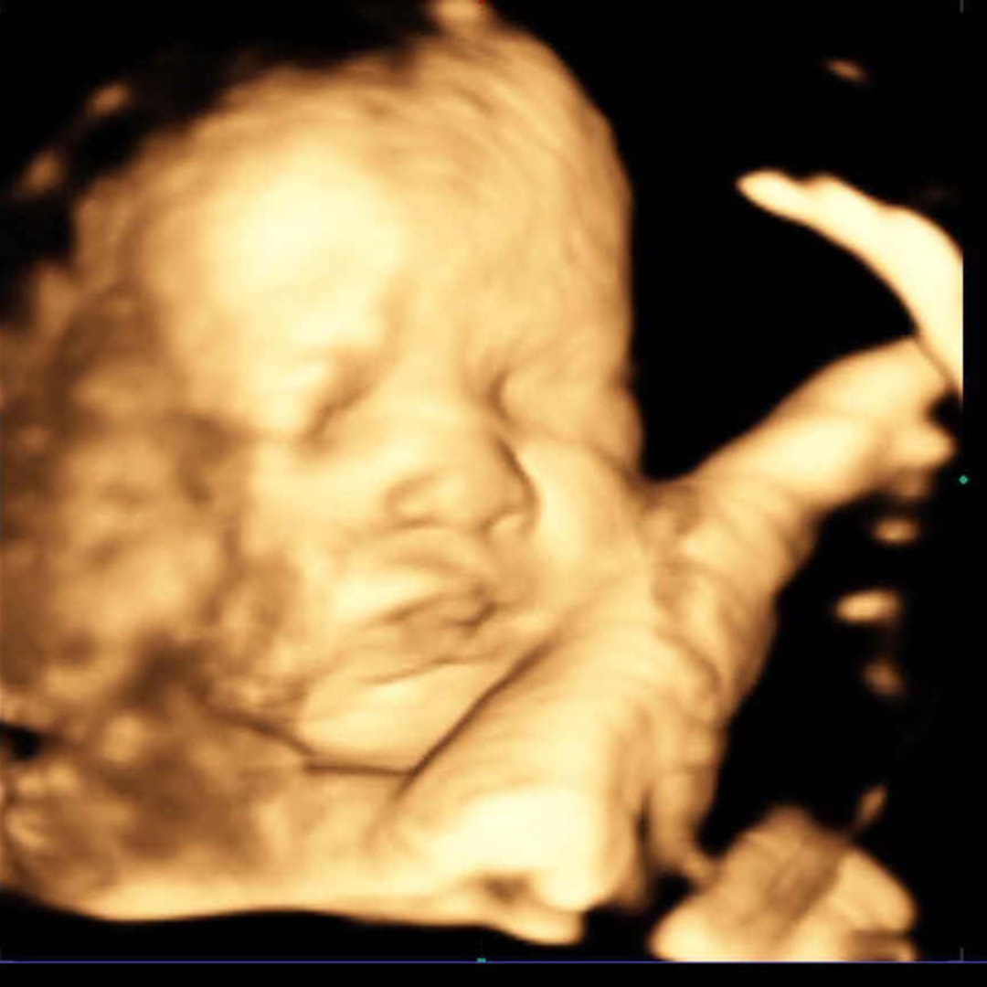 Photo shared by Melissa for their Babylist baby registry.
