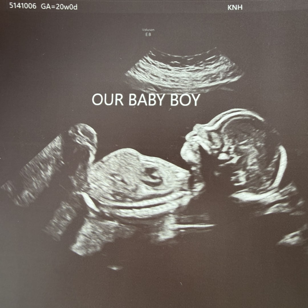 Photo shared by Ashley for their Babylist baby registry.