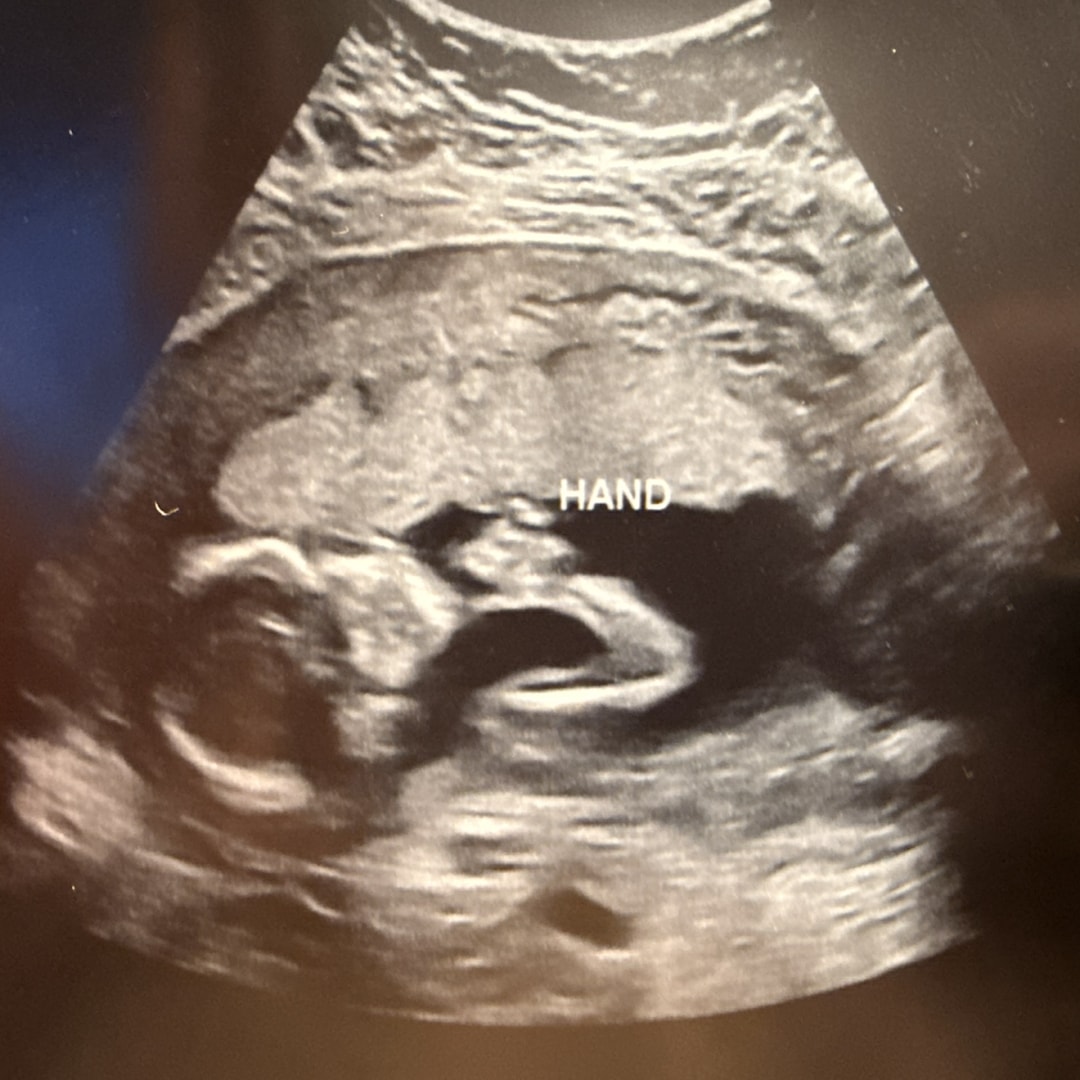 Photo shared by Jaycie for their Babylist baby registry.