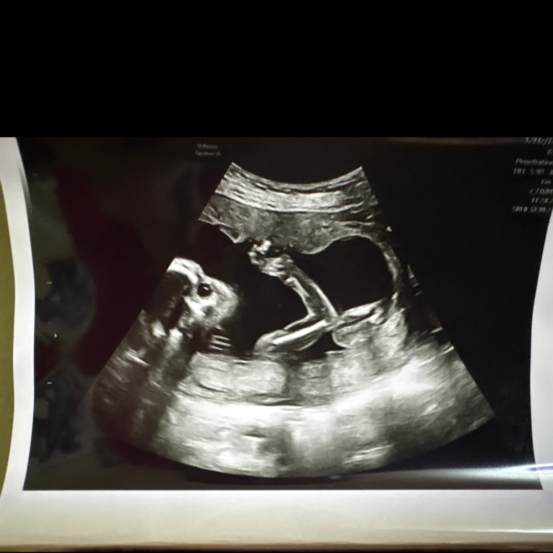 Photo shared by Savannah for their Babylist baby registry.