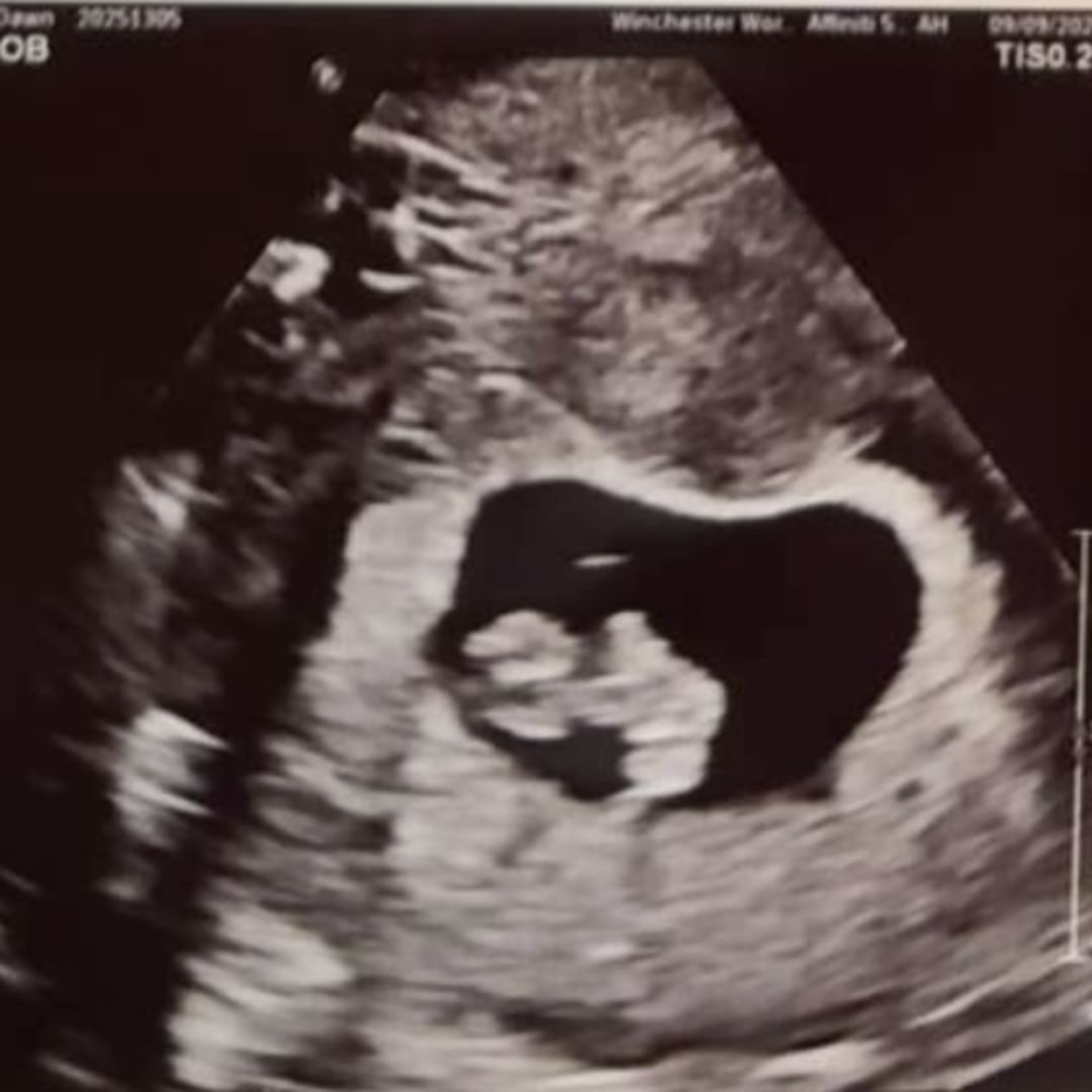 Photo shared by Ashlyn for their Babylist baby registry.