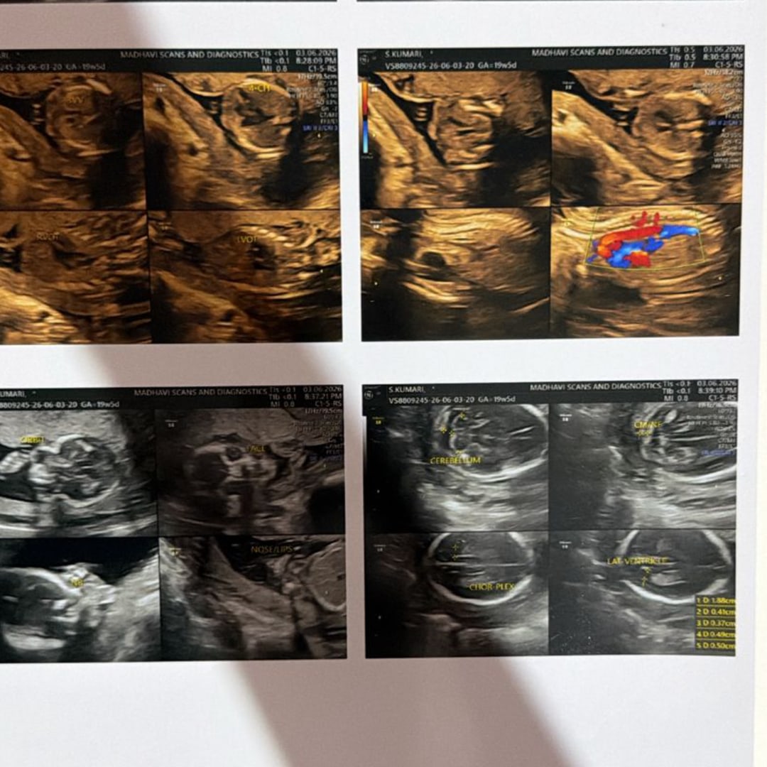 Photo shared by Bhargav for their Babylist baby registry.