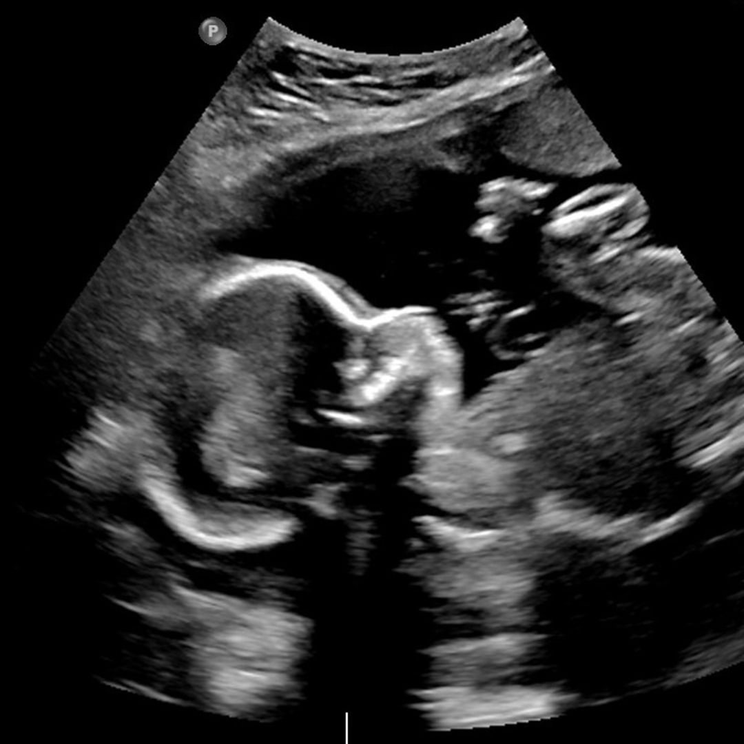 Photo shared by Erinn for their Babylist baby registry.