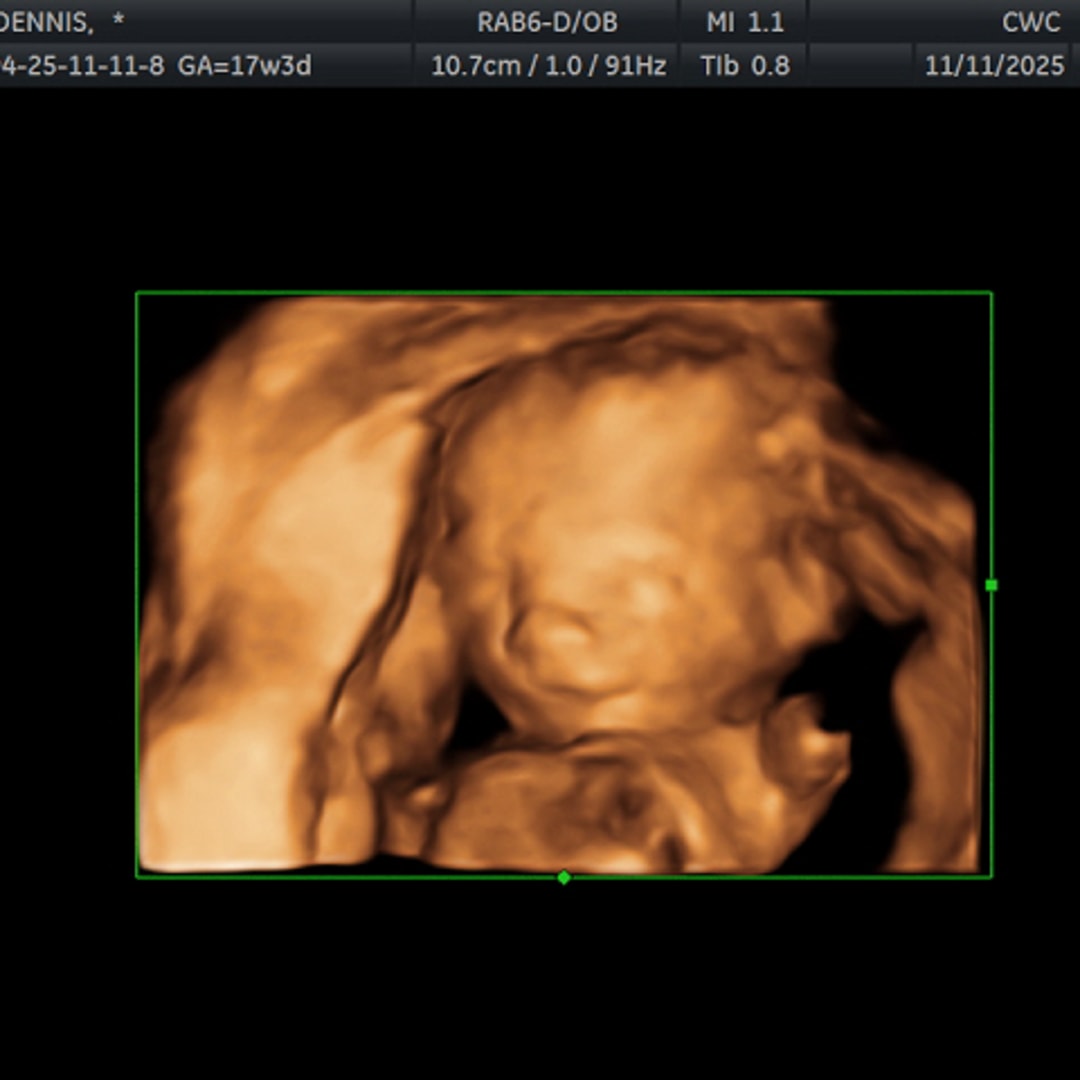 Photo shared by Shailea for their Babylist baby registry.