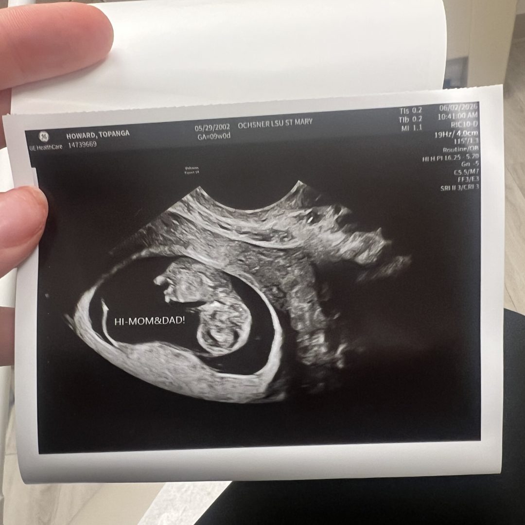 Photo shared by Topanga for their Babylist baby registry.