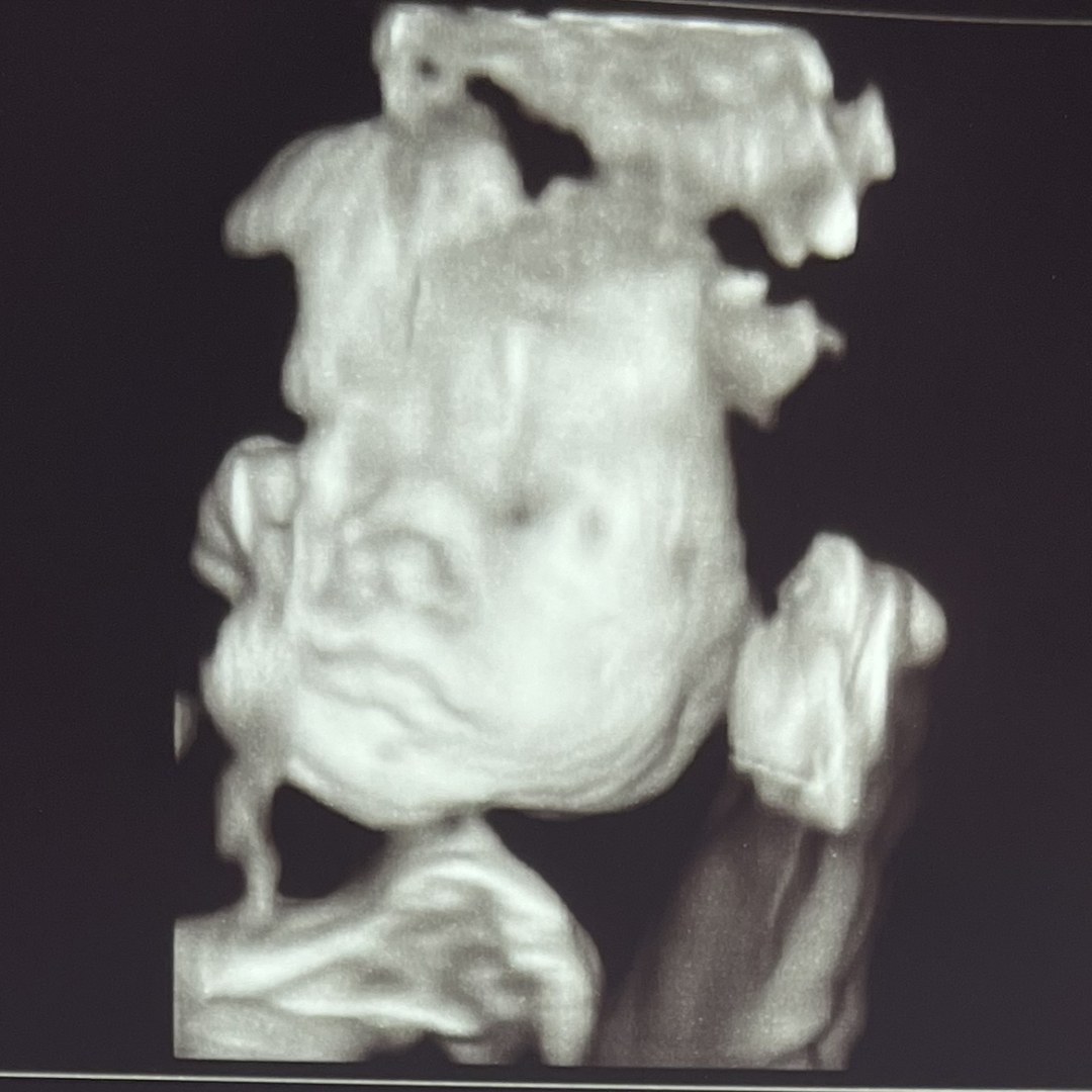 Photo shared by Kayla for their Babylist baby registry.
