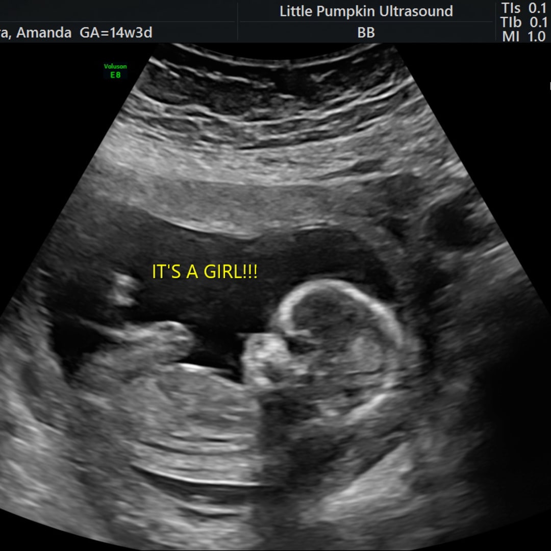 Photo shared by Amanda for their Babylist baby registry.