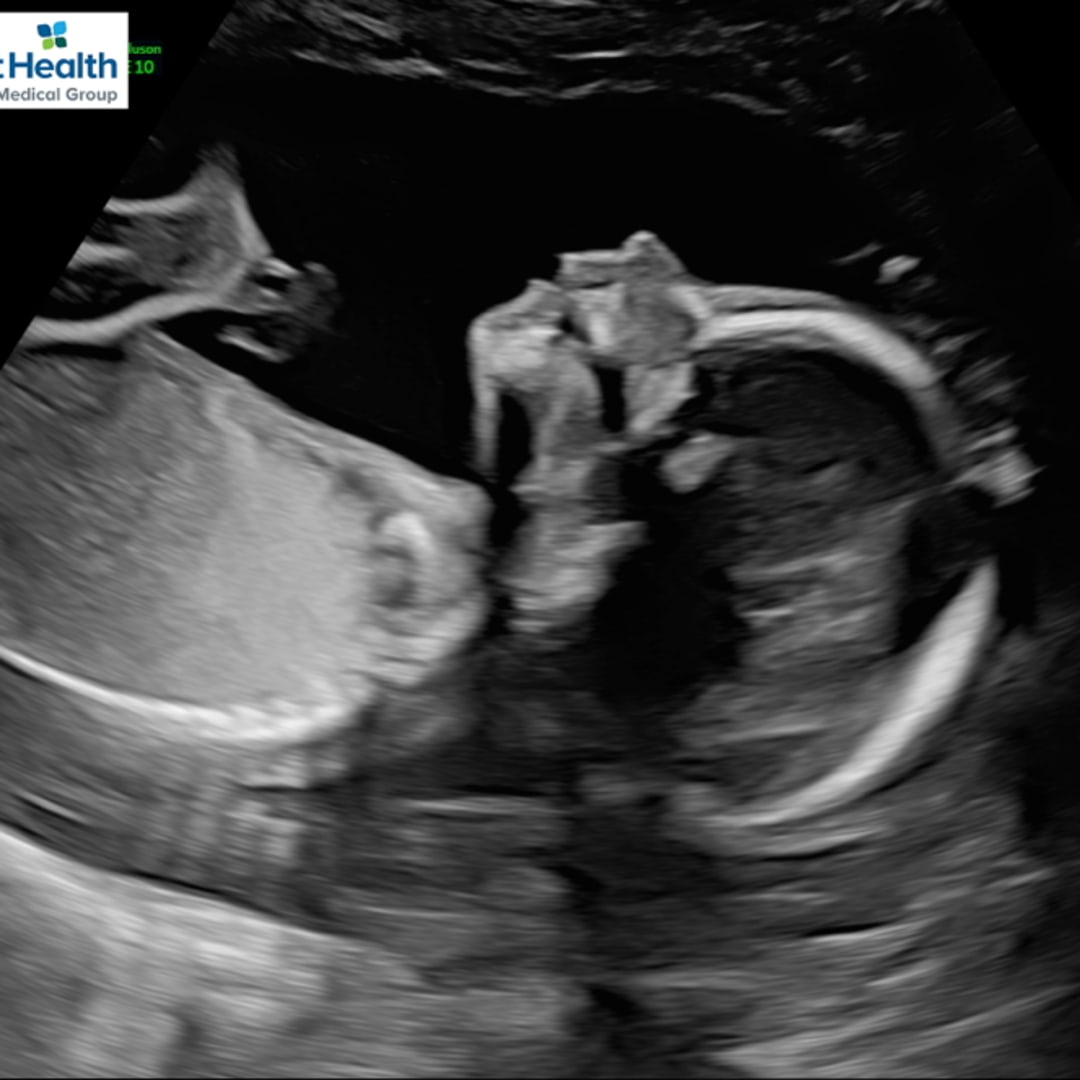 Photo shared by Mariana for their Babylist baby registry.