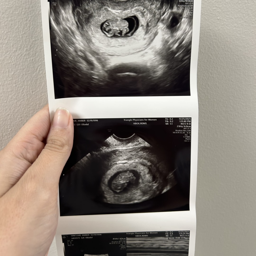 Photo shared by Amber for their Babylist baby registry.