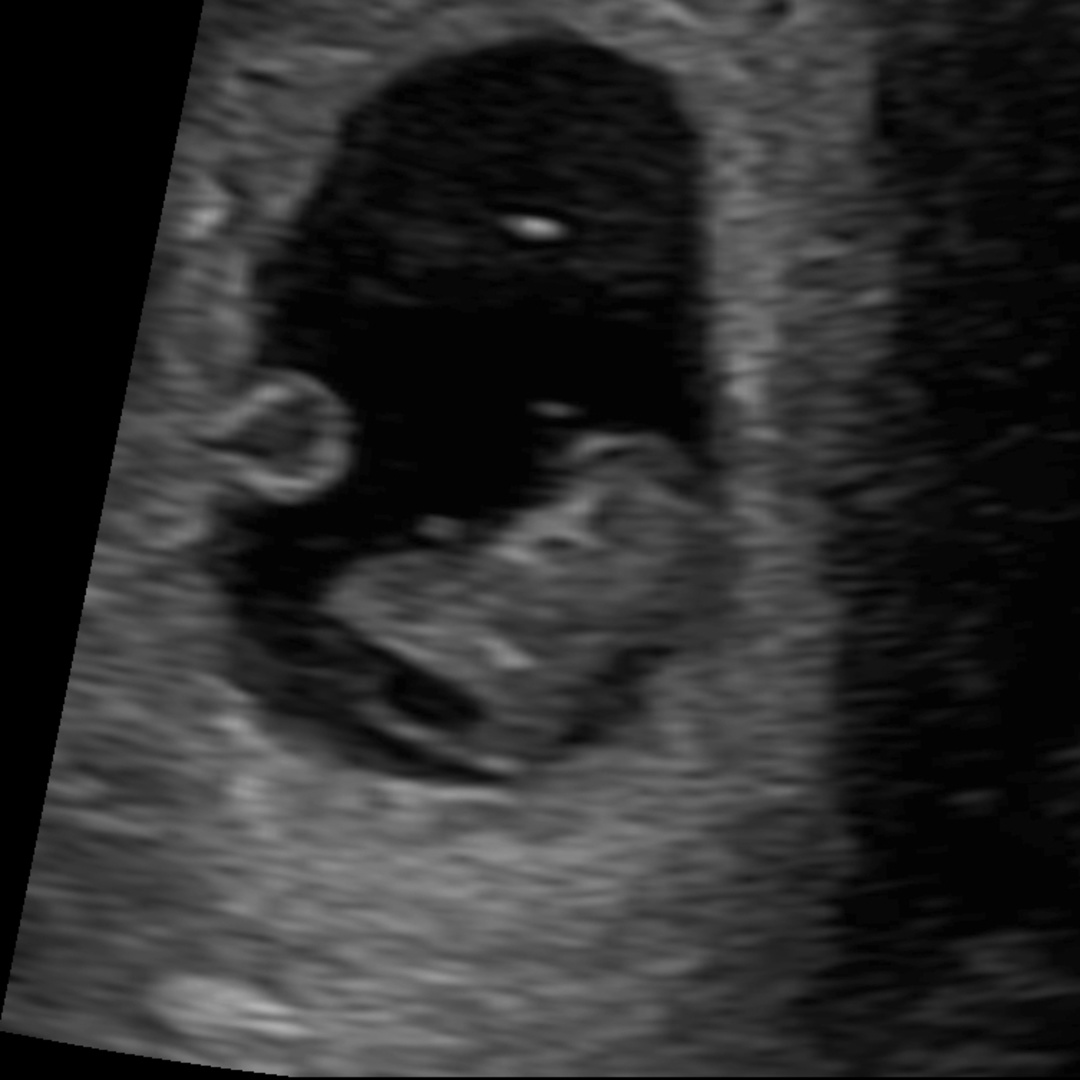 Photo shared by Amanda Ray for their Babylist baby registry.