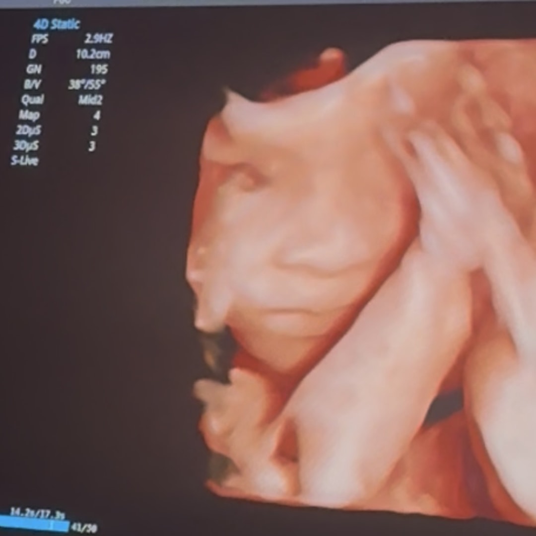 Photo shared by Isis for their Babylist baby registry.
