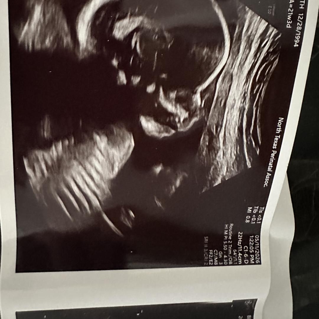 Photo shared by Elizabeth for their Babylist baby registry.