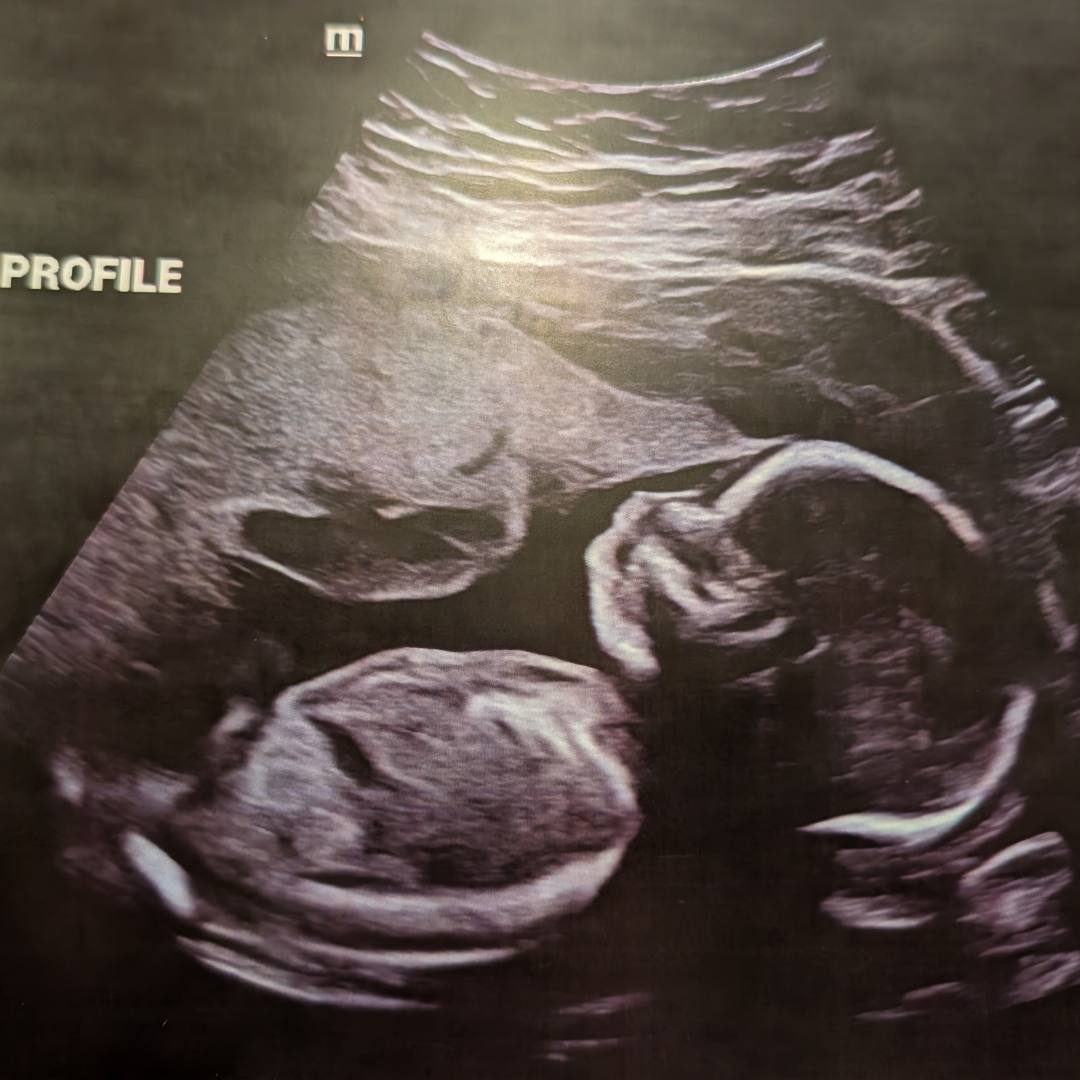 Photo shared by Courtney for their Babylist baby registry.