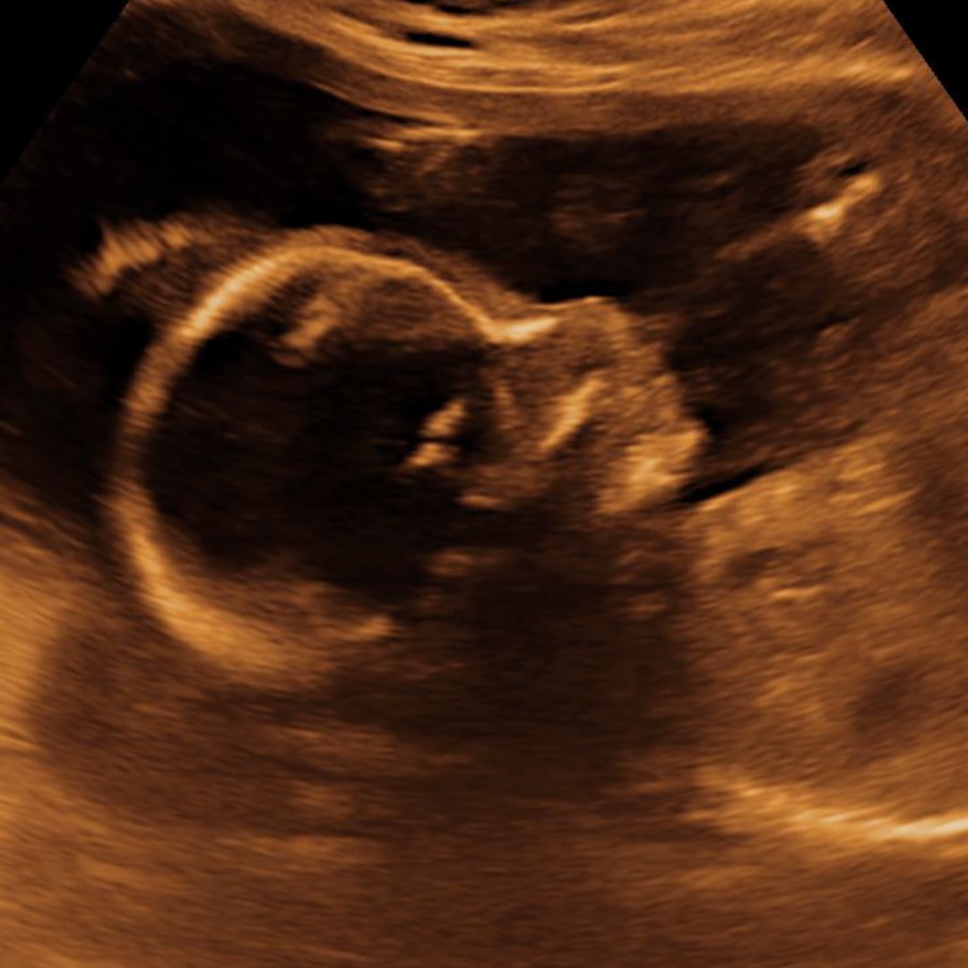 Photo shared by Heather for their Babylist baby registry.