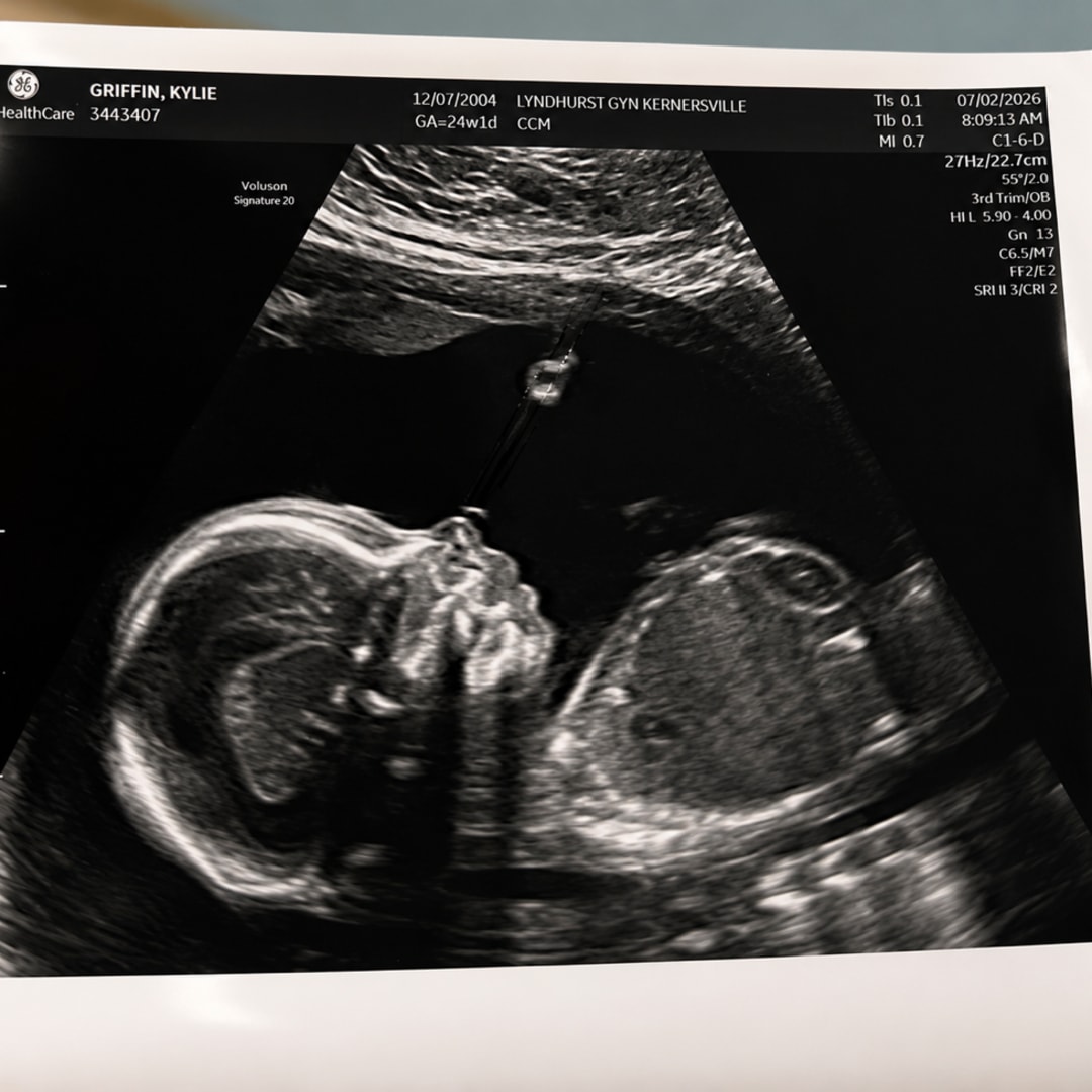 Photo shared by Kylie for their Babylist baby registry.