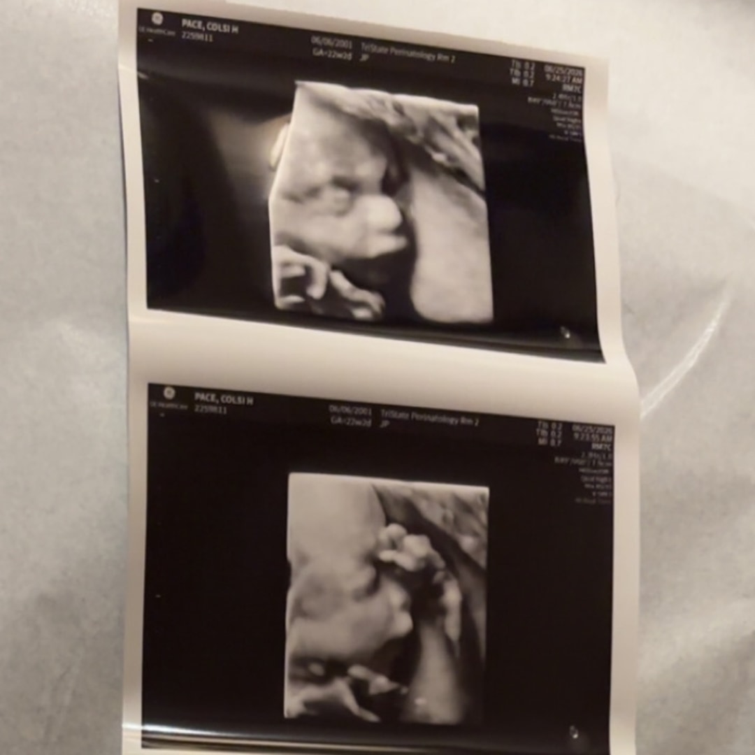 Photo shared by Colsi for their Babylist baby registry.