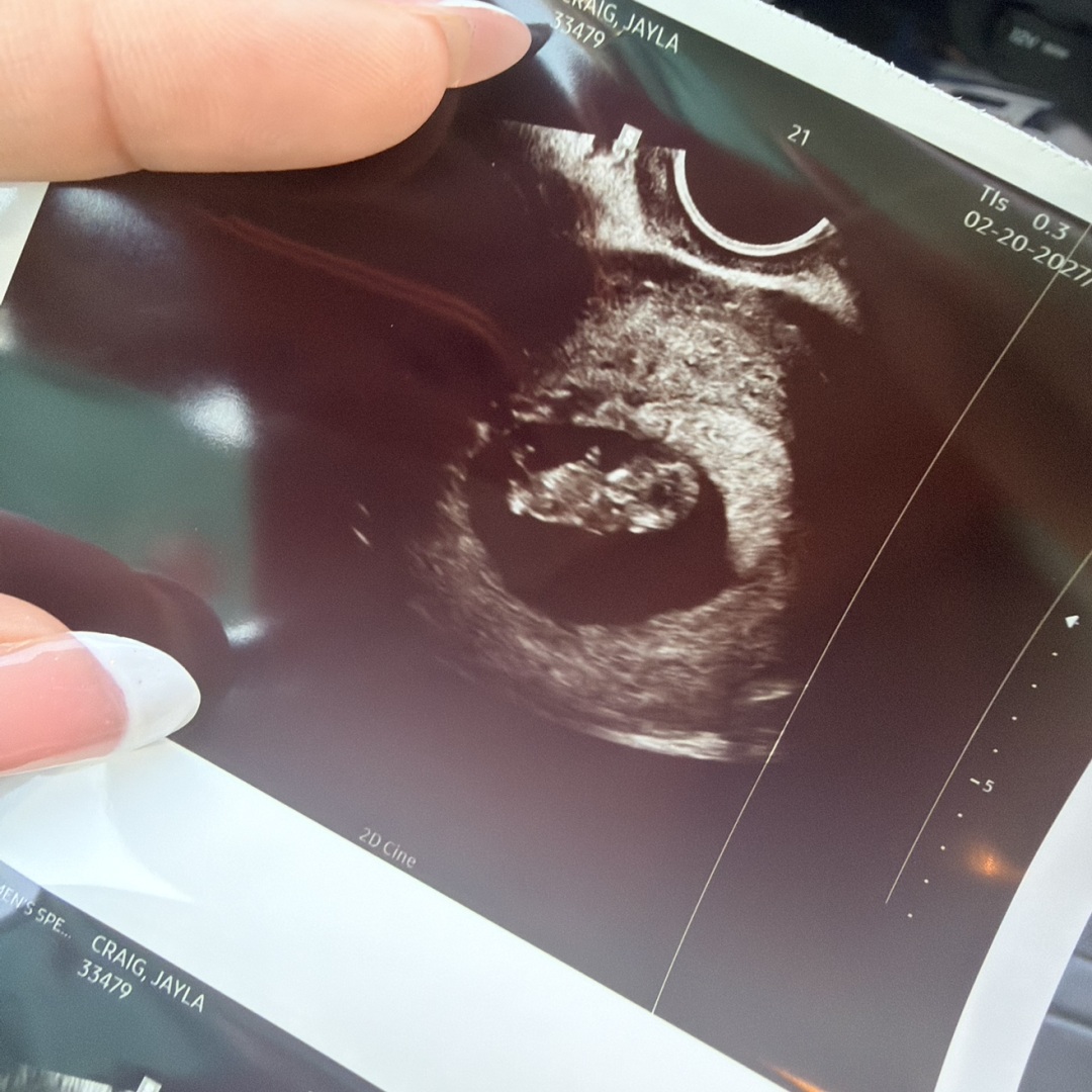 Photo shared by Jayla for their Babylist baby registry.