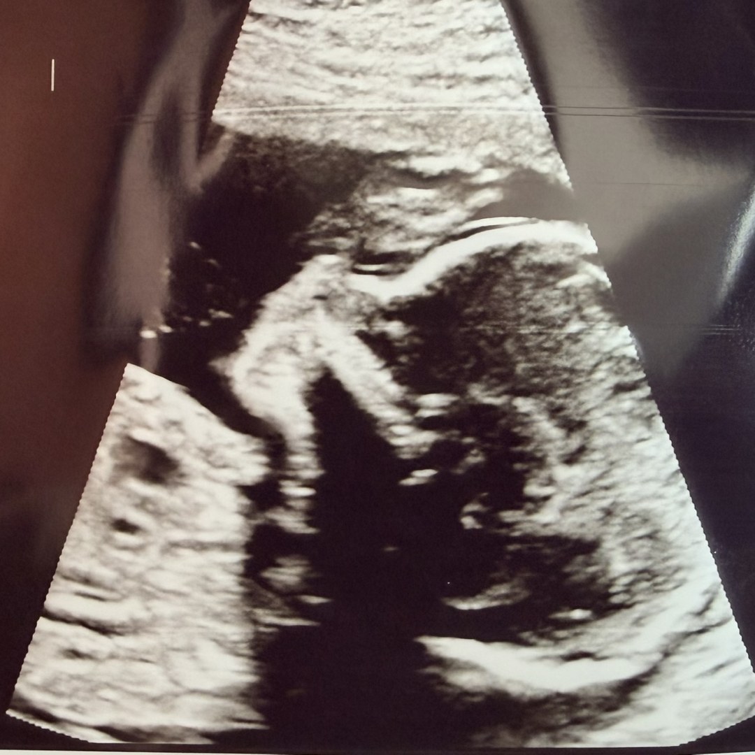 Photo shared by Caeli for their Babylist baby registry.