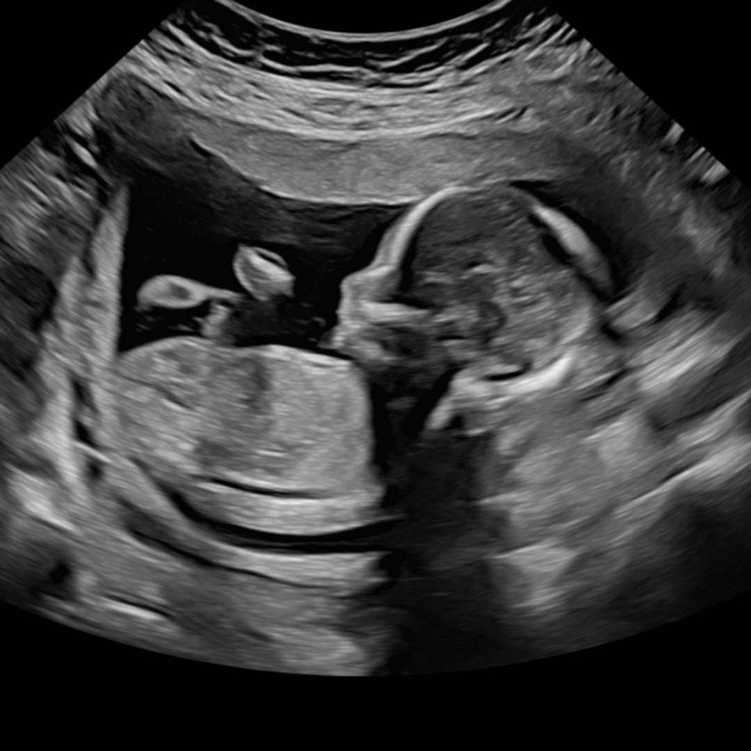 Photo shared by Rachel for their Babylist baby registry.