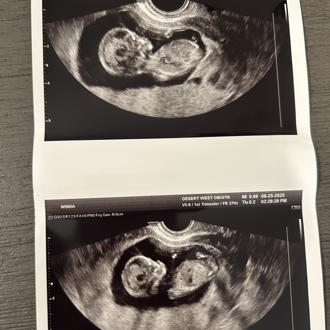 Photo shared by Shelbie for their Babylist baby registry.