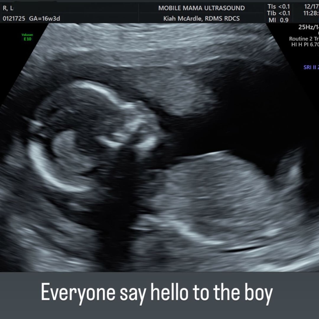 Photo shared by Lynsey for their Babylist baby registry.