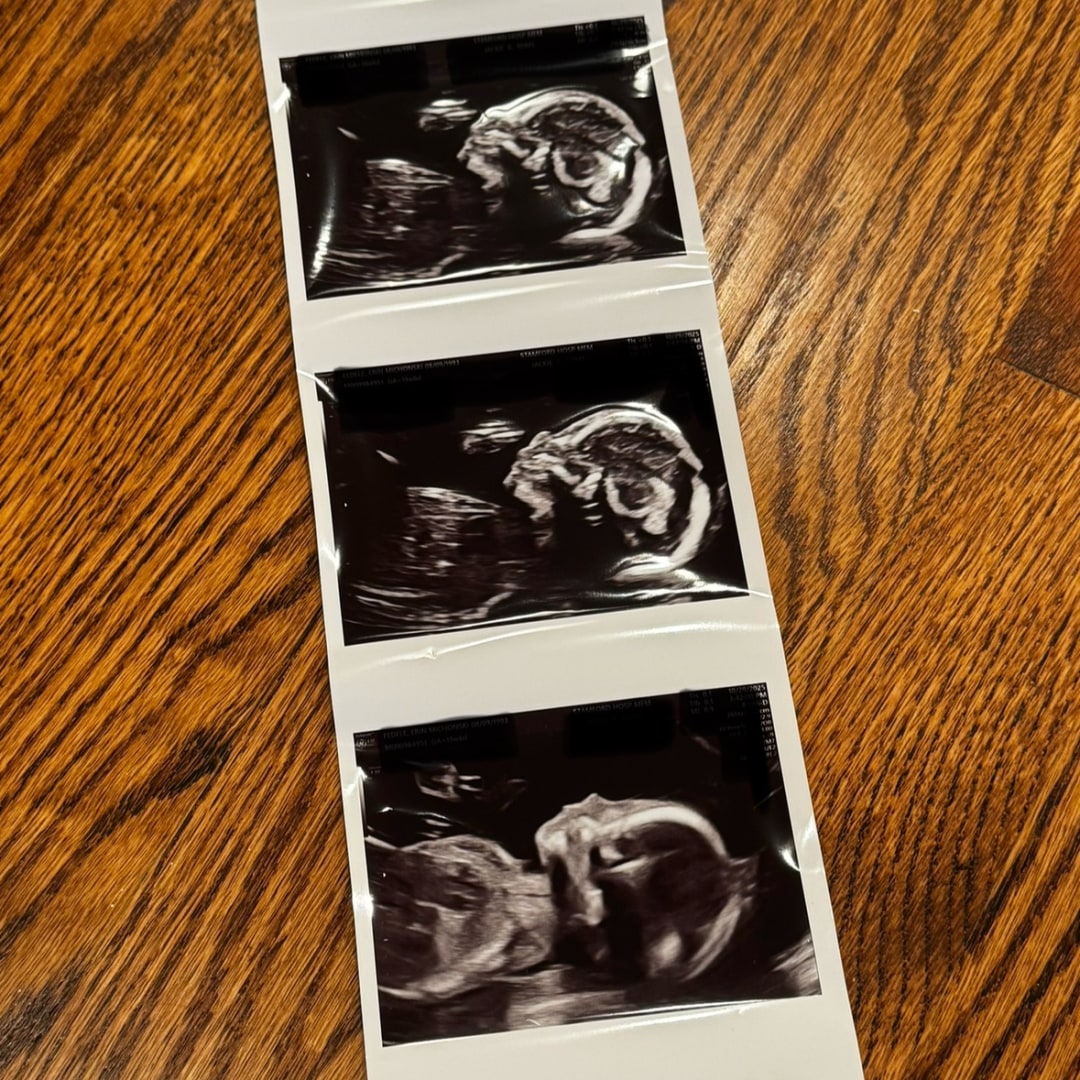 Photo shared by Erin for their Babylist baby registry.