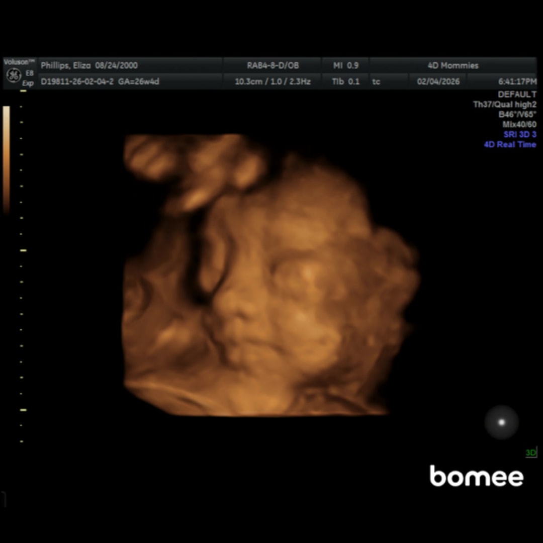 Photo shared by Eliza for their Babylist baby registry.