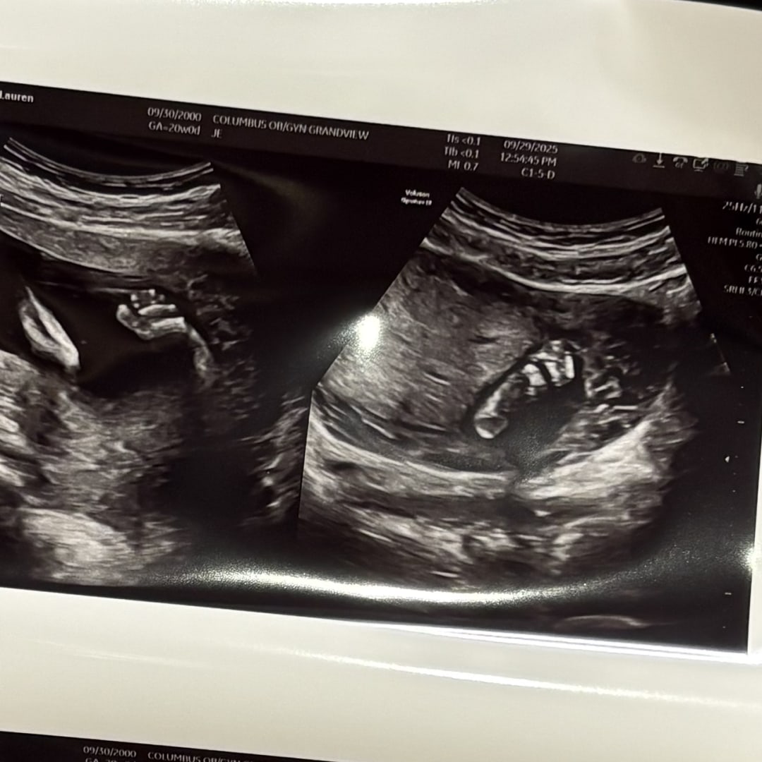 Photo shared by Lauren for their Babylist baby registry.