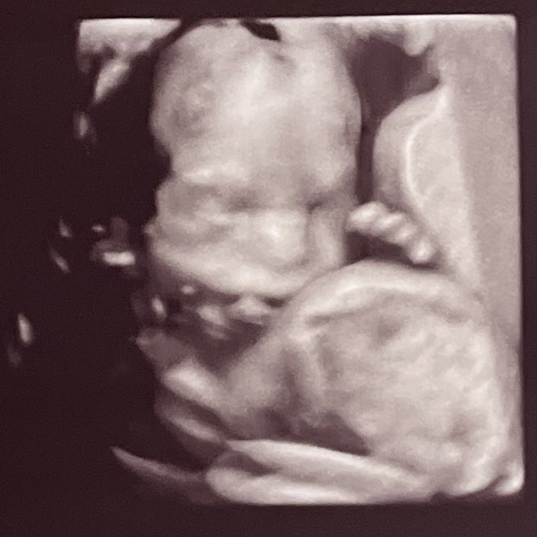 Photo shared by Molly for their Babylist baby registry.