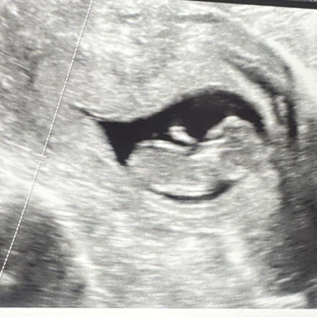 Photo shared by Holly for their Babylist baby registry.