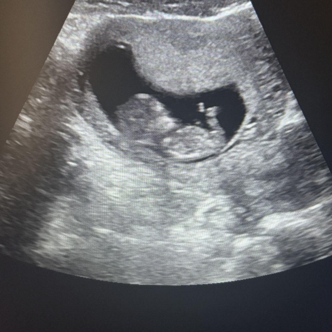Photo shared by Melissa for their Babylist baby registry.