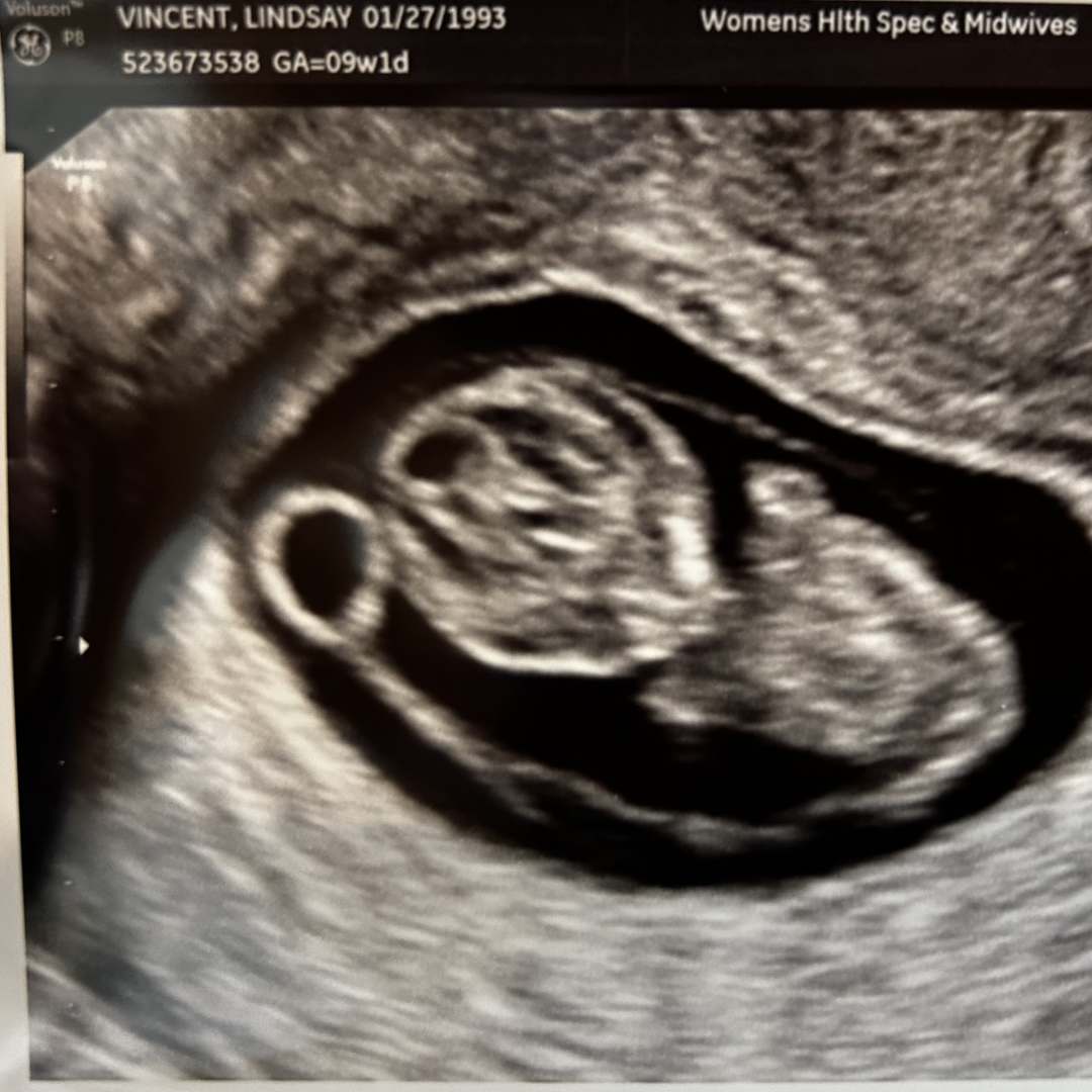 Photo shared by Braden for their Babylist baby registry.