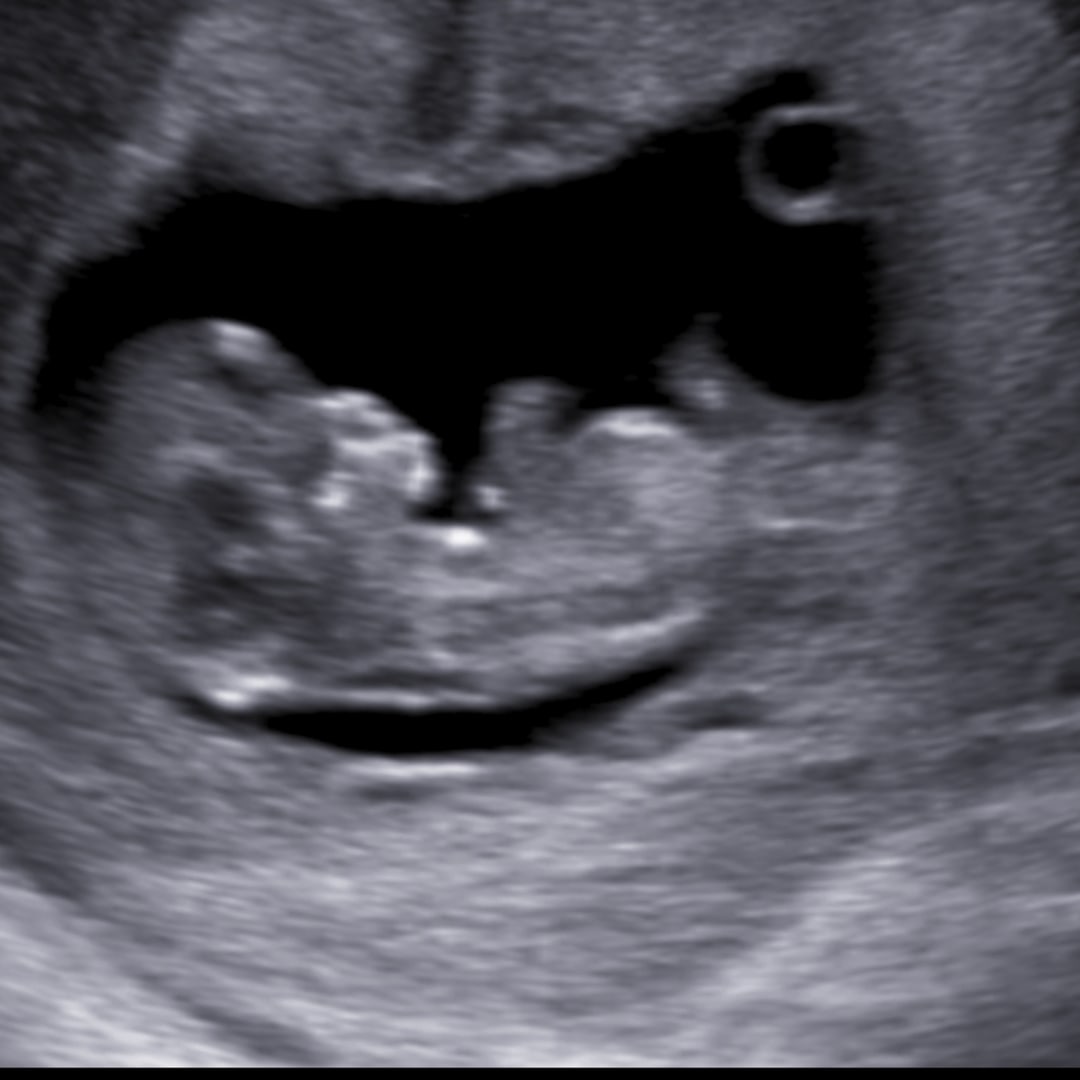 Photo shared by Autumn for their Babylist baby registry.