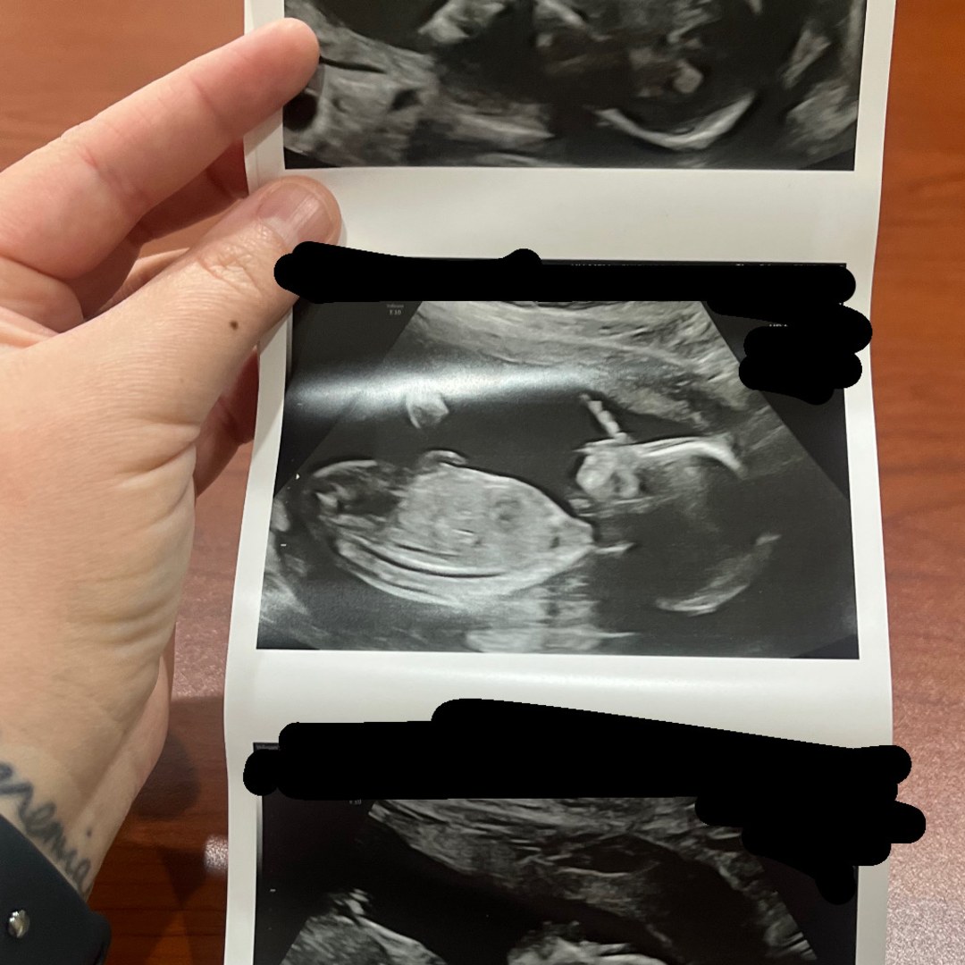 Photo shared by Hanna for their Babylist baby registry.