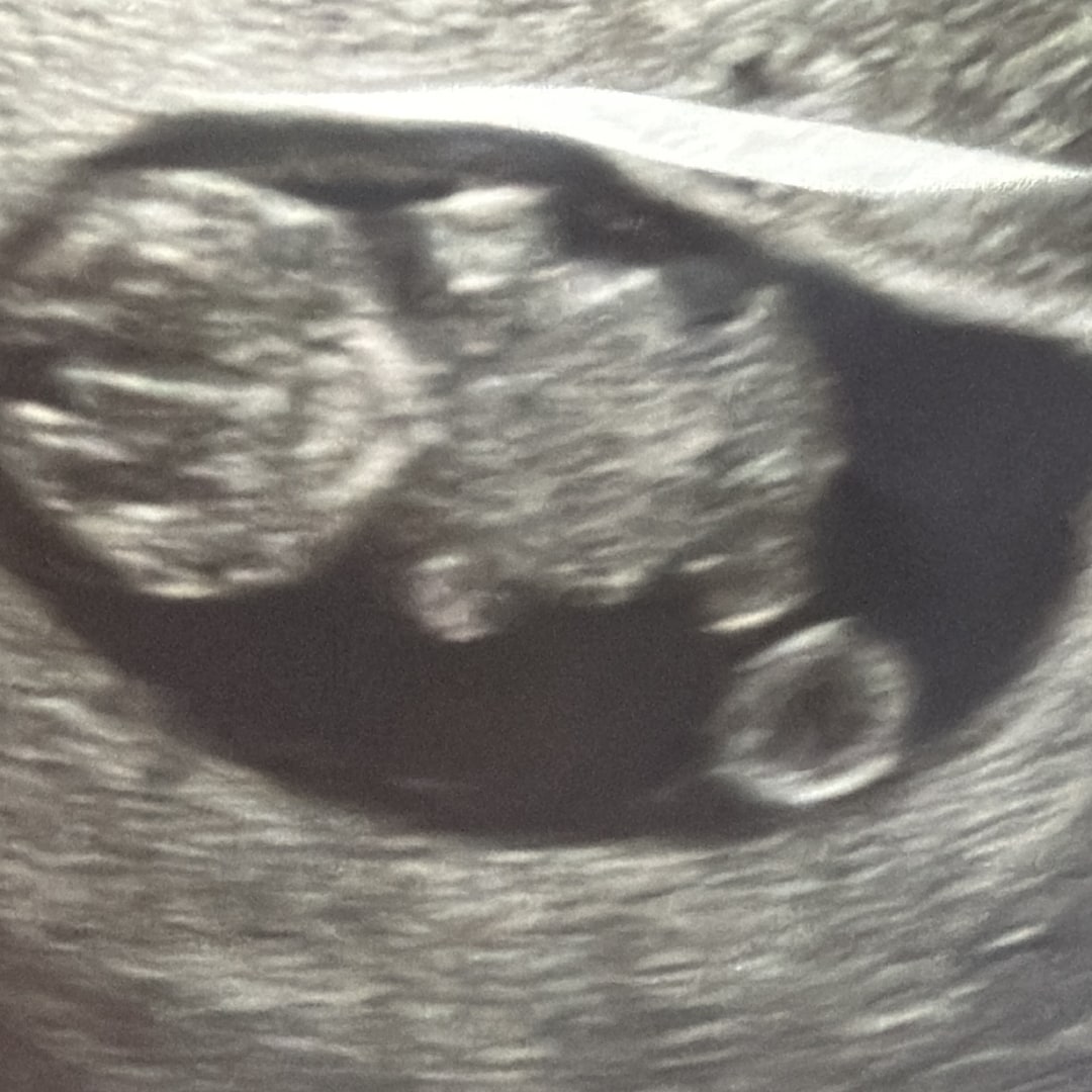 Photo shared by Dahara for their Babylist baby registry.