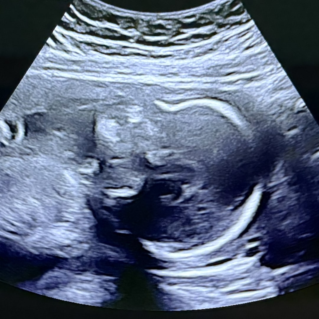 Photo shared by Dailyn for their Babylist baby registry.